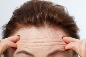 Acetyl Hexapeptide-3 Prevent Wrinkles